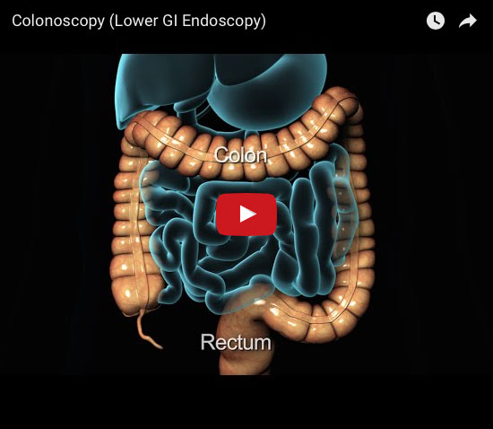 sigmoidoscopy buffalo ny